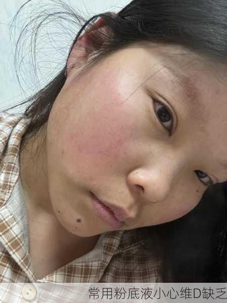 常用粉底液小心维D缺乏
