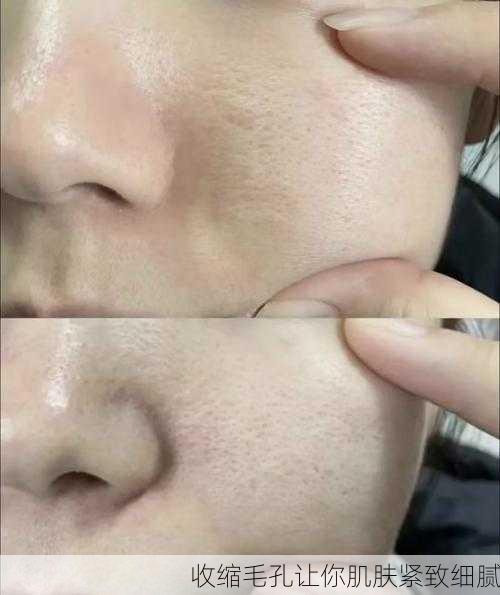 收缩毛孔让你肌肤紧致细腻